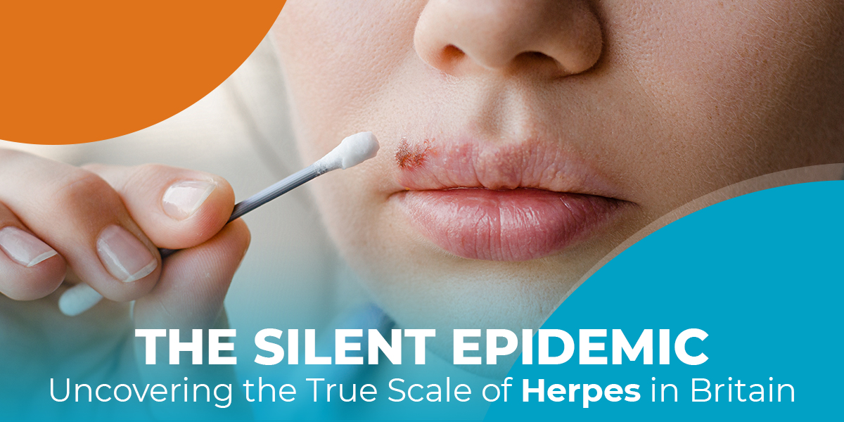 The Silent Epidemic: Uncovering the True Scale of Herpes in Britain